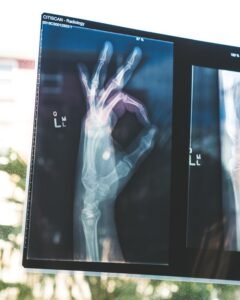 xray of a hand